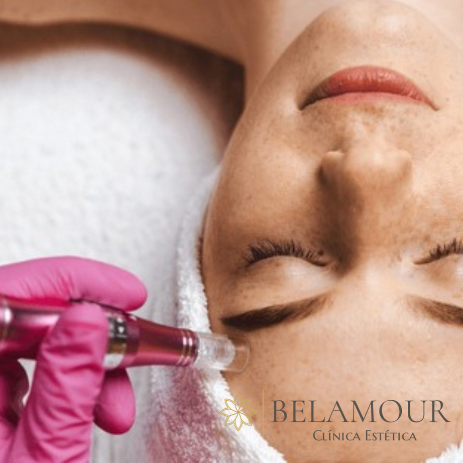 Dermapen VITAMINAS PINK GLOW (3 Sesiones)