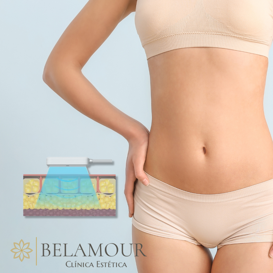 1 Sesión Criolipólisis Plana + EMS Abdomen Alto - Bajo + Flancos